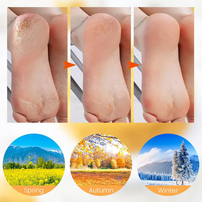 ✨ 50% OFF! Moisturizing Foot Mask Socks – Silicone gel locks in moisture, releases plant oils. Softens cracks & rough skin – wear with shoes for all‑day care! 🌿🧦