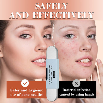 💓HOT SALE 50% OFF🔥Stainless Steel Blackhead Remover Tool Kit