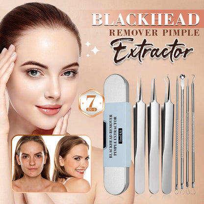 💓HOT SALE 50% OFF🔥Stainless Steel Blackhead Remover Tool Kit
