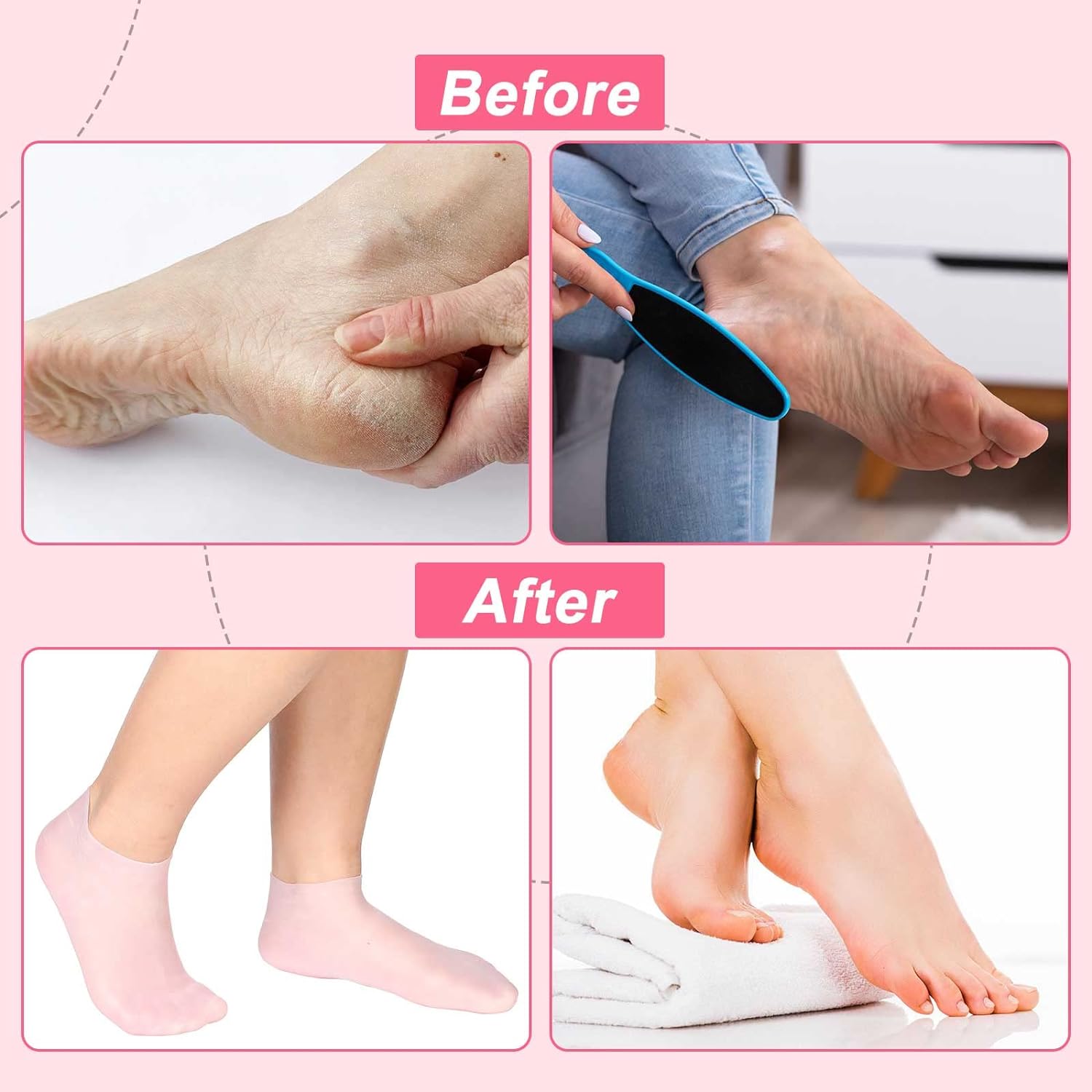 ✨ 50% OFF! Moisturizing Foot Mask Socks – Silicone gel locks in moisture, releases plant oils. Softens cracks & rough skin – wear with shoes for all‑day care! 🌿🧦