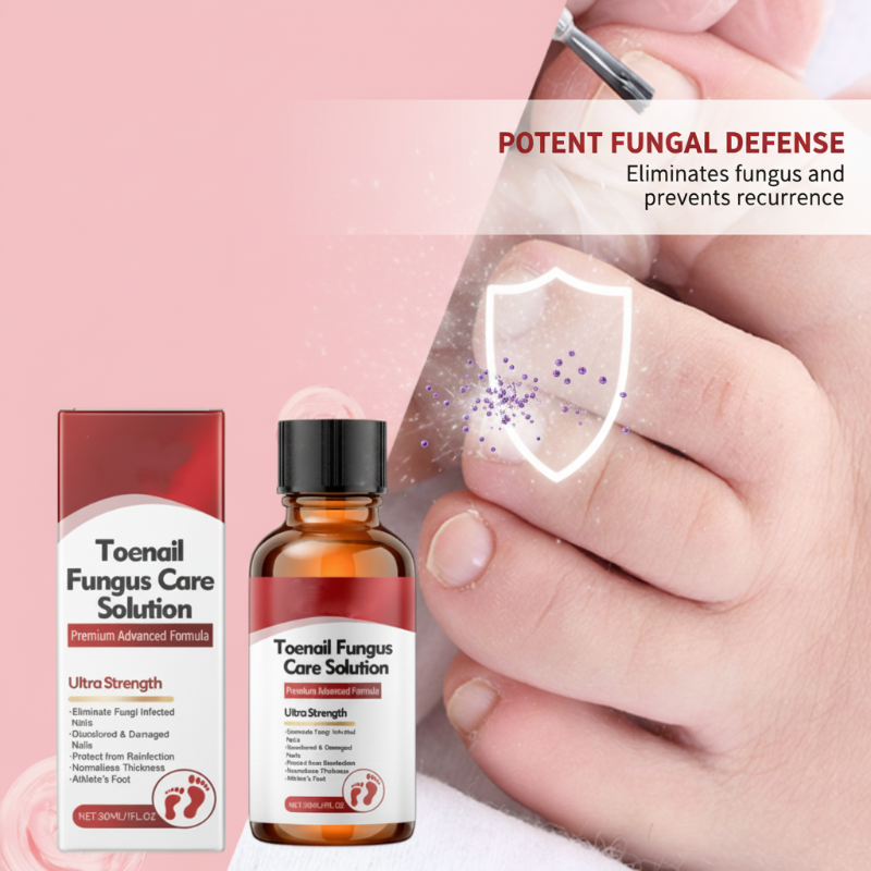 🔥Hot Sale-50%OFF!🔥Nail Repair Essence for Damaged Nails💅🏻
