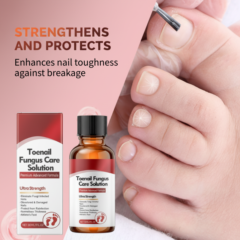 🔥Hot Sale-50%OFF!🔥Nail Repair Essence for Damaged Nails💅🏻
