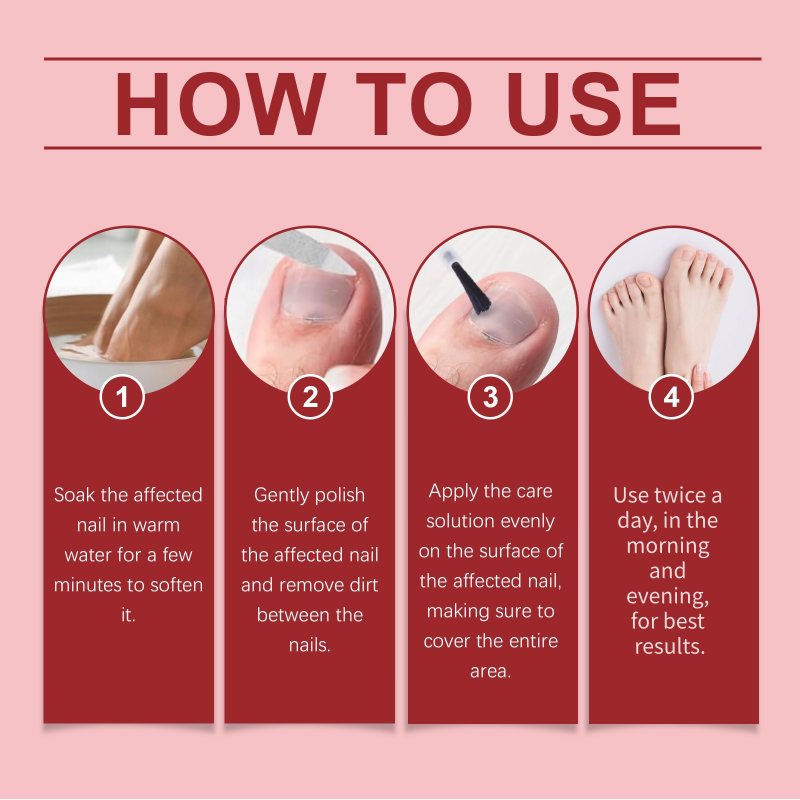 🔥Hot Sale-50%OFF!🔥Nail Repair Essence for Damaged Nails💅🏻