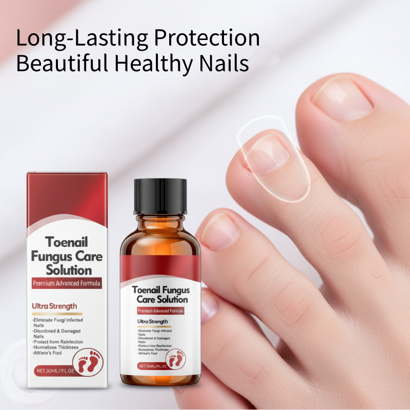 🔥Hot Sale-50%OFF!🔥Nail Repair Essence for Damaged Nails💅🏻