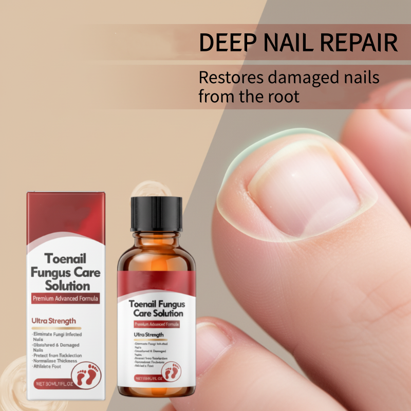 🔥Hot Sale-50%OFF!🔥Nail Repair Essence for Damaged Nails💅🏻