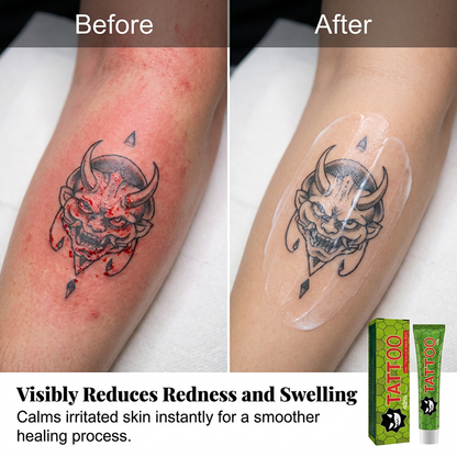 🔥Hot Sale 50% OFF🔥 Help Your Scar Fade! Silicone Scar Cream – Soften. Flatten. Smooth. ✨