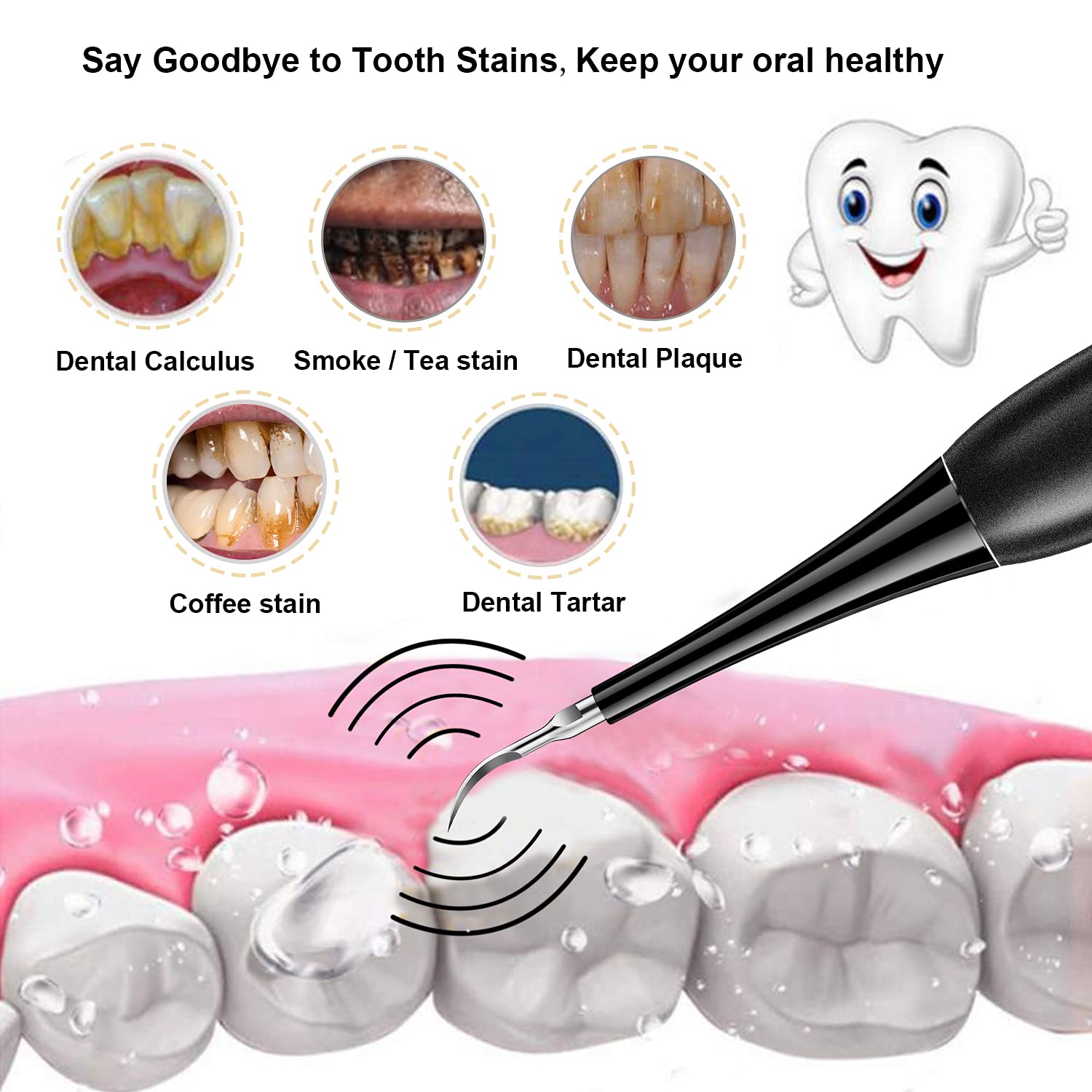 💎Surprise Price ￡9.99!!🦷✨Electric Ultrasonic Dental Scaler for Tartar and Plaque Removal