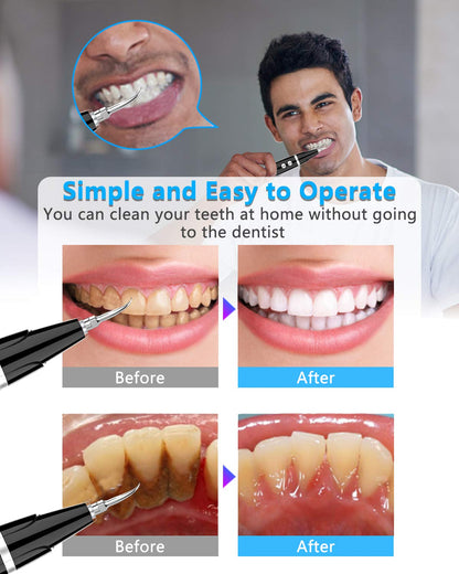 💎Surprise Price ￡9.99!!🦷✨Electric Ultrasonic Dental Scaler for Tartar and Plaque Removal