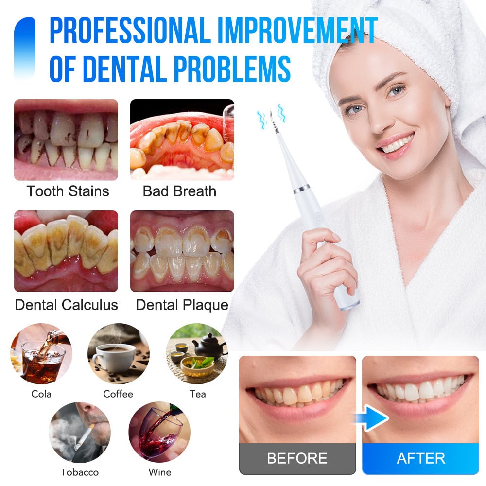 💎Surprise Price ￡9.99!!🦷✨Electric Ultrasonic Dental Scaler for Tartar and Plaque Removal
