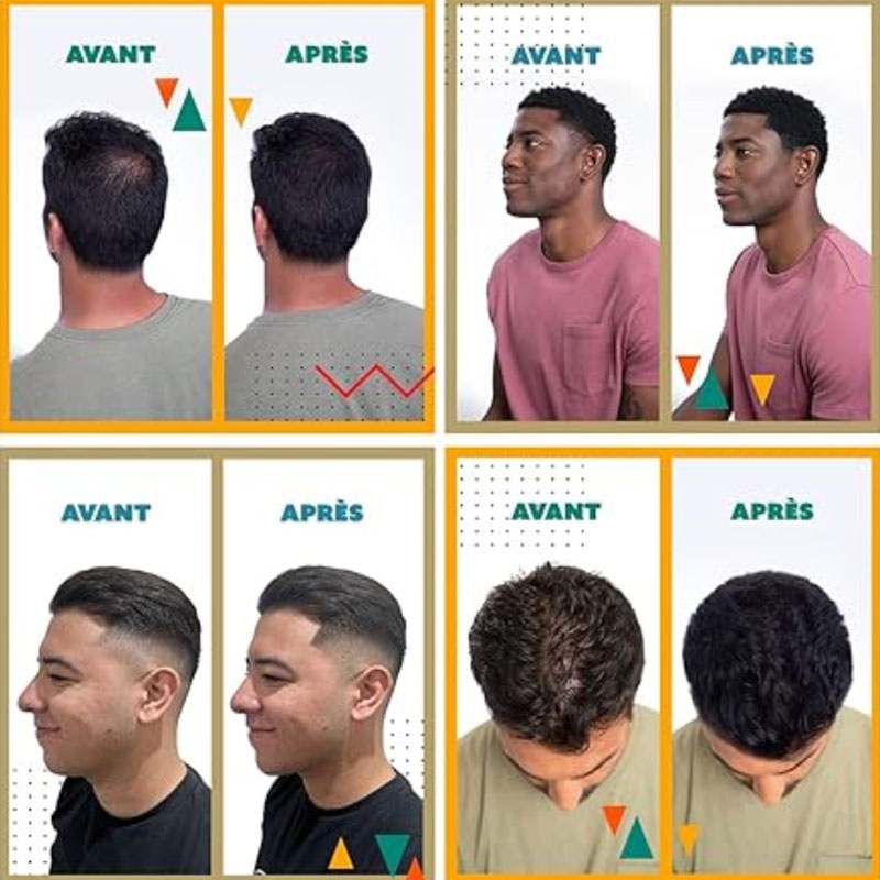 🔥HOT SALE 50% OFF🎁Hair Building Fibers Set for Thinning Hair & Bald Spots